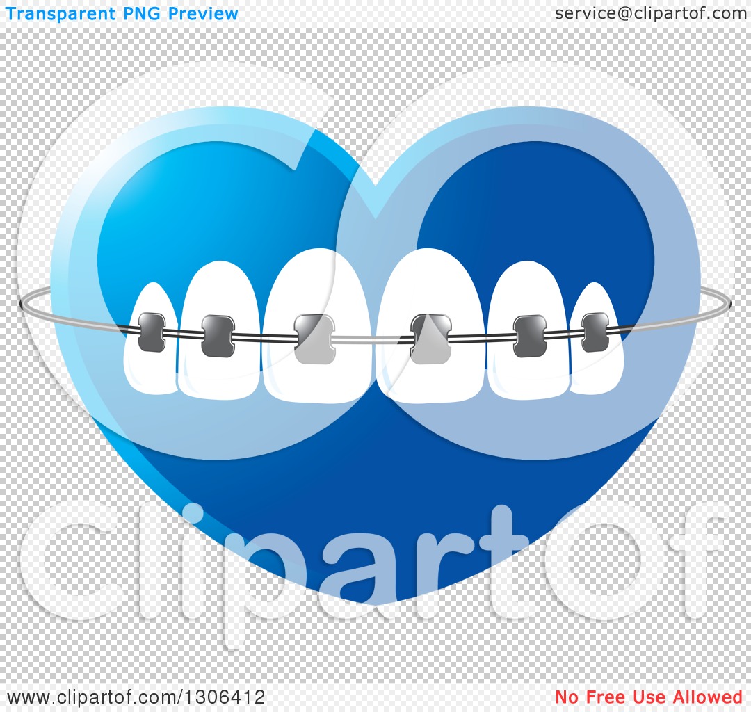 orthodontic clipart