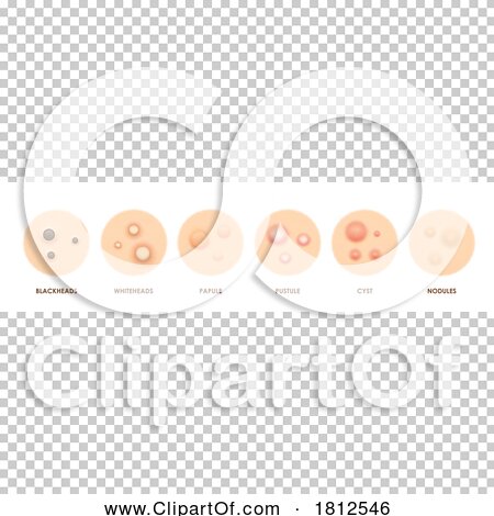 Transparent clip art background preview #COLLC1812546