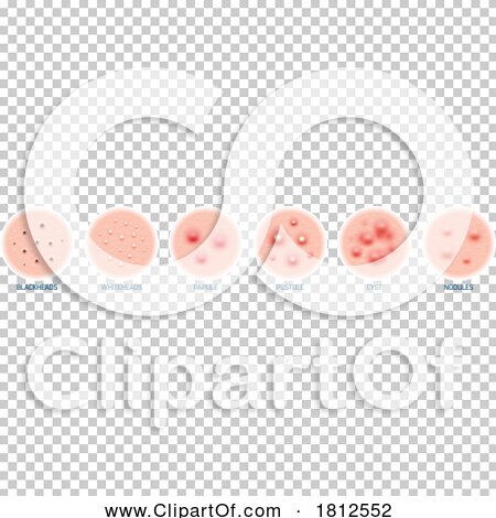 Transparent clip art background preview #COLLC1812552