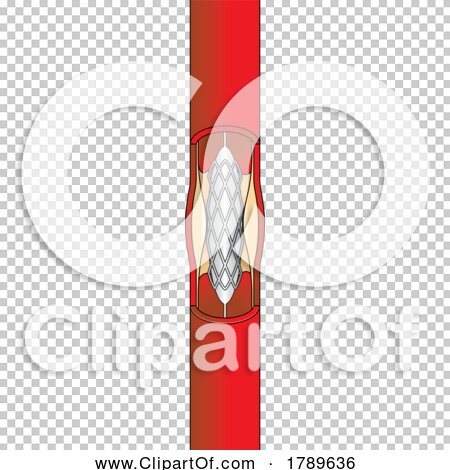 Transparent clip art background preview #COLLC1789636
