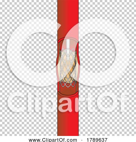 Transparent clip art background preview #COLLC1789637